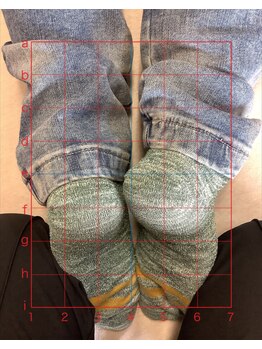 カイロプラクティック シュラーフ/踵の左右差で骨盤のズレをみます