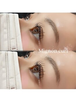 ルーフアイ(ROOF EYE)/ROOF EYE(ルーフ アイ)