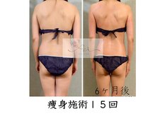 アイ エステサロン(Ai)/【40代】痩身◎着たい服を着れる