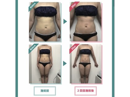 レニフォーメン(reni for men)の写真