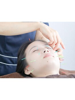 鍼灸施術を受けたい