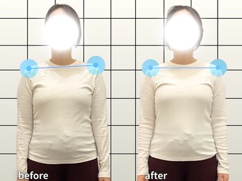 アクティブフィジオ 武蔵小杉/マタニティ・肩こり・頭痛