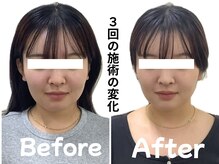 オレンジ鍼灸整体院/美容鍼灸で、むくみ・たるみに◎