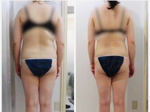 アイディエム 新宿店(IDM)/【モニター】164cm・30代