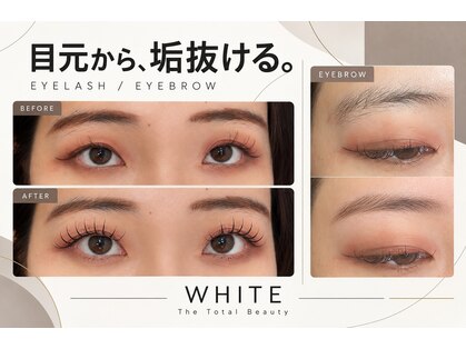 ホワイト(WHITE)の写真
