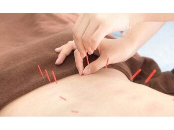 ラクシア げんき堂整骨院 イオンモール京都桂川/鍼ケア