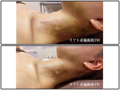 インディバケアプラチナム 麻布十番店の写真