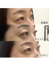 サンライズ(SUNRISE)/