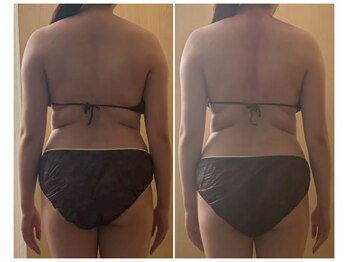 マイティー整骨院 ココア(CoCoa)/活性リンパ洗浄