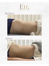 エイル 大橋(Eir.)/before/after