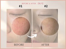 シンスプラス(SINCE+)/ハイドロ＋クリスティーナ