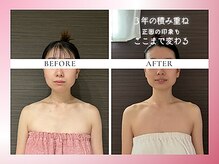 リスブランビューティー(Lys Blanc Beauty)/９０分コルギ／３年の変化