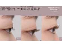 アイグロス(Eye Gloss)/