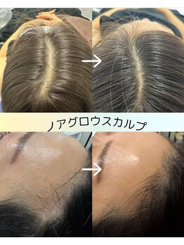 サロン ピューパ(Salon pupa)/スカルプケアBefore→After