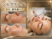 ビュウナ 銀座(BEAUNA)の雰囲気（紫外線ダメージをケアし、しっとり潤いのある美白肌へ！）