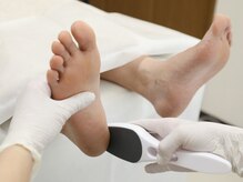 リフレリア(REFLERIA)/踵の角質ケアの様子