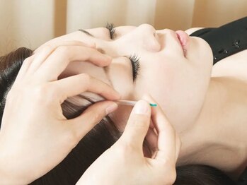 くつろぎ鍼灸整体院の写真/ひどい肩こり、腰痛、自律神経の乱れ、美容に最適☆初めての方もやさしい鍼で施術致します◎