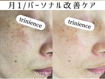 トリニエンス 新宿店(TRINIENCE)/40代/シミケア/パーソナルケア