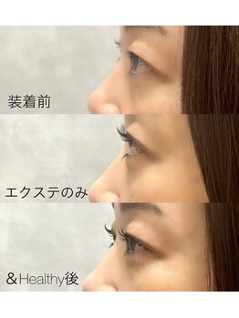 サンライズ(SUNRISE)/