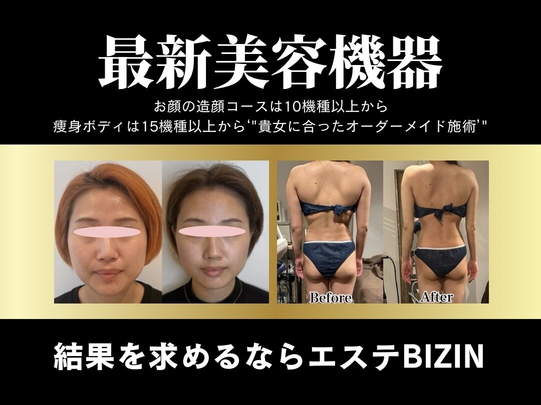 動作確認済み 難あり ビューティポット 痩身エステマシン ワゴン別売り 2025年最新】マジックポット エステの人気アイテム - メルカリ