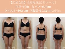 エターナルフレーム(Eternal Flame)/50歳痩身2カ月短期集中コース