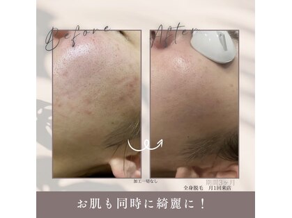 モア トゥインクル 緑井店(MORE twinkle)の写真