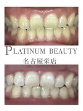 プラチナムビューティー 名古屋栄本店(PLATINUM BEAUTY)/お客様Before After 