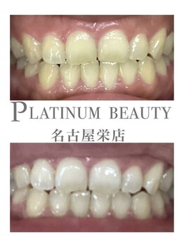 プラチナムビューティー 名古屋栄本店(PLATINUM BEAUTY)/お客様Before After