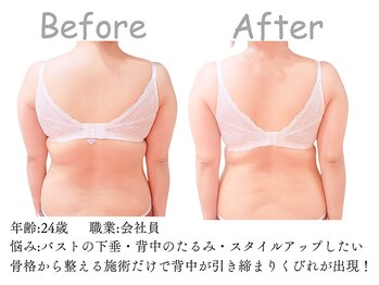 シエル(Siele)/痩身エステ以上の感動