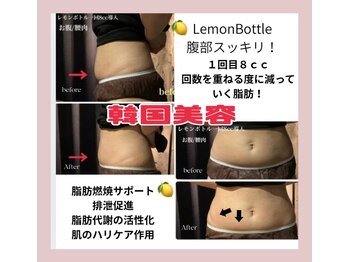 アイビー 亀田店(IVY)