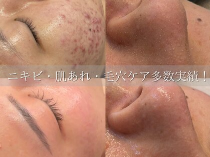 サロンドペオニー 川内店(salon de peony)の写真