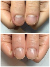 スマイルニコ(smile nico)/親指の伸びが凄い