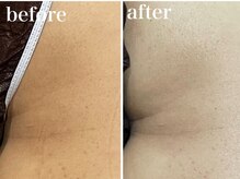 ビ ボーテ(美 Beaute)/ツルツル美尻へ♪