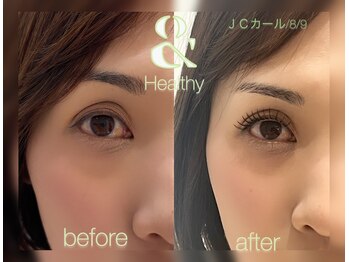 サンライズ(SUNRISE)/