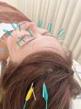 田井整体 整骨院/美容鍼灸の効果をさらにUP！