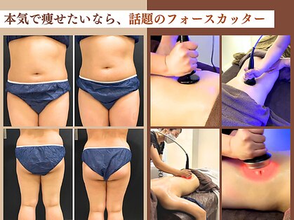 スパチャーレ(Spa ciare)の写真