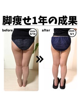 エステ リラクゼーションサロン(more)/脚集中痩せ/ダイエット（痩身）