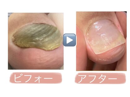 ウォーク(Walk)の写真