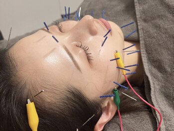 シア(SCIA)の写真/鍼灸師による本格的な鍼灸施術と整体・矯正で、一人ひとりのお悩みに寄り添うケアを◎