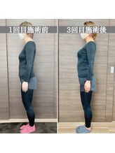 シェア 人形町店(Chare)/【小顔・骨盤矯正・О脚・整体】