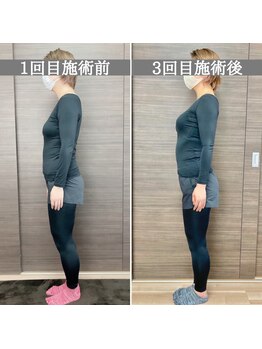 シェア 人形町店(Chare)/【小顔・骨盤矯正・О脚・整体】