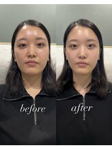 シロ(silo.)/幹細胞フェイシャル・ヘッドスパ