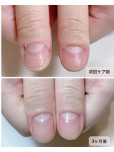 カピリナ(Ka Pilina)/自爪育成