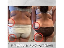 メルディアナ(MAR DIANA)の雰囲気（脂肪冷却痩身は《中々痩せない…》を卒業したい方向け！）