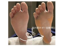 ピエモワ 渋谷(PiEmoi)/足指のケアもお任せください♪