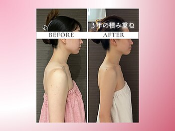 リスブランビューティー(Lys Blanc Beauty)/９０分コルギ／３年の変化