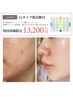 【早く結果を出したい方へ】肌診断+複数メニュー複合施術90分/￥16,500→