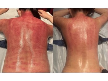epani　Beauty Salonの写真/【都度払いOK】勧誘なしで気軽に通える痩身サロン。初めての方や自分のペースで無理なく続けたい方へ。