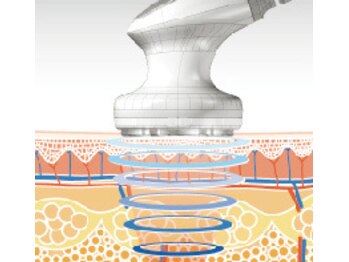 エステドルース(esthe de Ruth.)/セルライトゼロ２