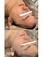 サロン ド ミニョン(salon de mignon)/驚きのbefore after♪